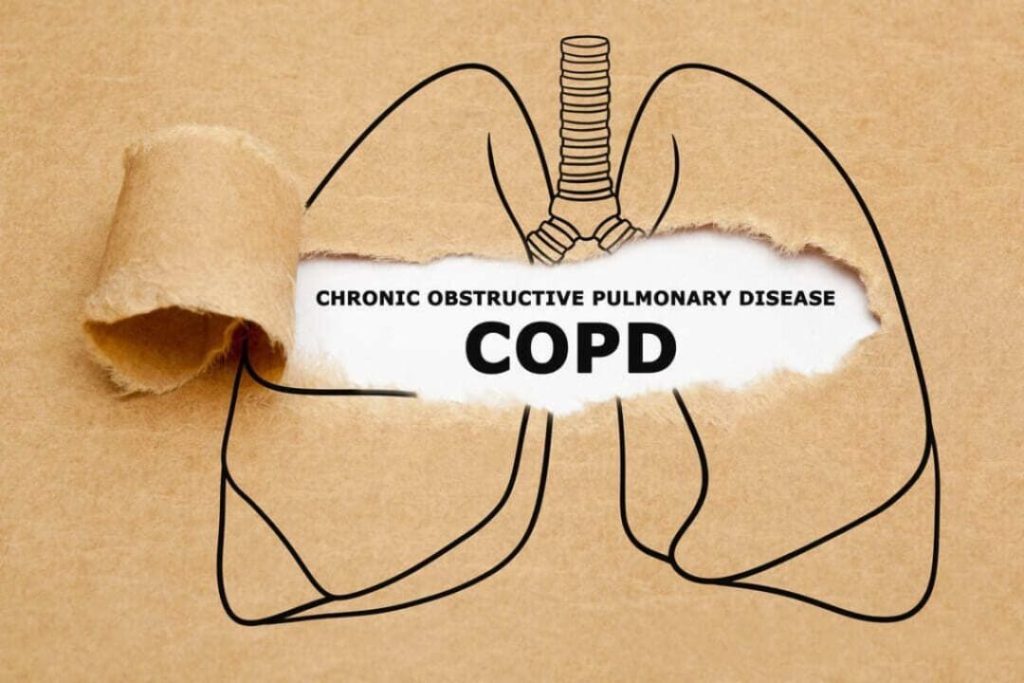 VA COPD RATING