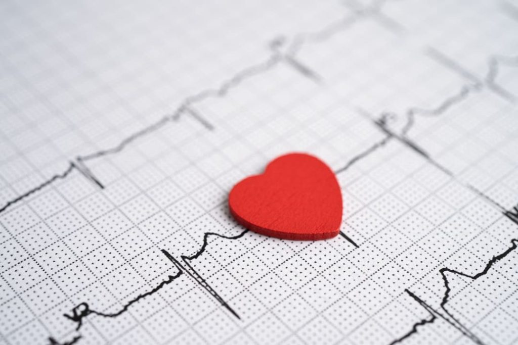 VA DISABILITY RATING FOR HEART ARRHYTHMIA