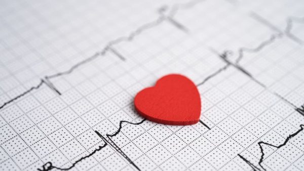 VA DISABILITY RATING FOR HEART ARRHYTHMIA.