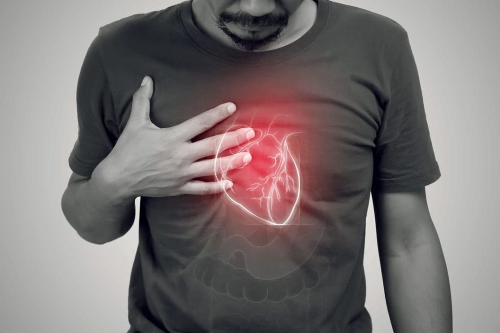 VA RATING FOR ATRIAL FIBRILLATION