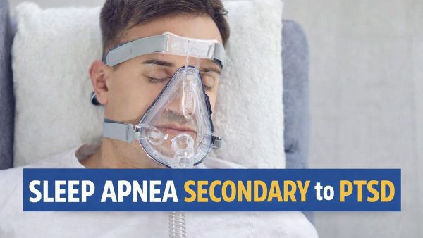 SLEEP APNEA SECONDARY TO PTSD