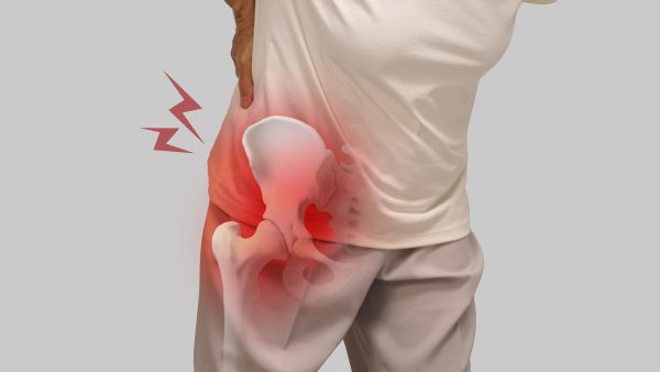 hip pain secondary to knee va disability