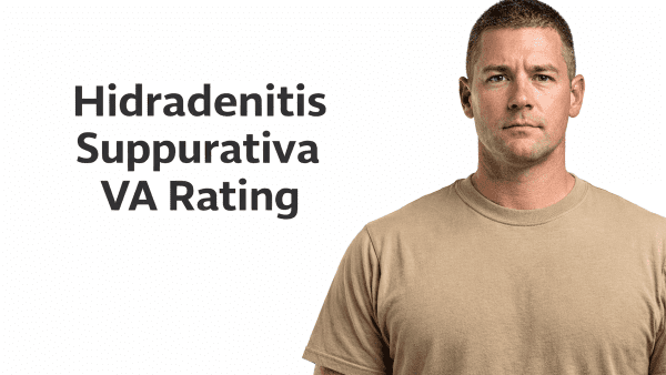HIDRADENITIS SUPPURATIVA VA RATING.