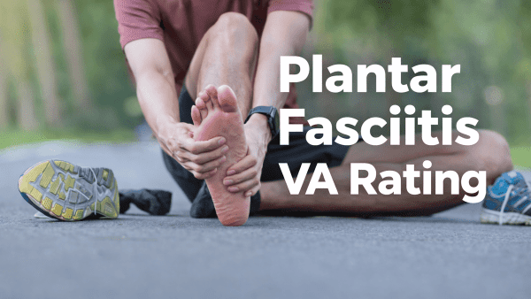 PLANTAR FASCIITIS VA RATING.