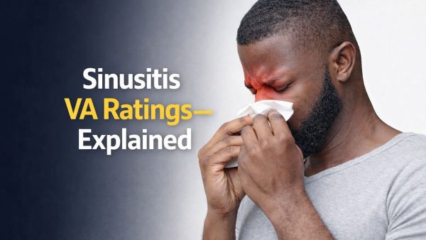 SINUSITIS VA RATING